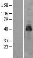 OSTM1 Human Over-expression Lysate