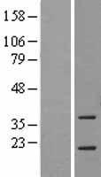 ASF1A Human Over-expression Lysate