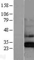 CLIC4 Human Over-expression Lysate