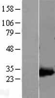 AK3L1 (AK4) Human Over-expression Lysate