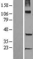TRHDE Human Over-expression Lysate
