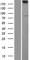 SERTAD3 Human Over-expression Lysate
