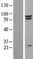 EEF2K Human Over-expression Lysate