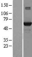STK39 Human Over-expression Lysate