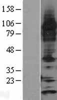 Thioredoxin 2 (TXN2) Human Over-expression Lysate