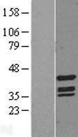 Tin2 (TINF2) Human Over-expression Lysate