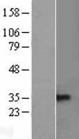 TACI (TNFRSF13B) Human Over-expression Lysate