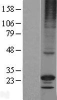 RGS17 Human Over-expression Lysate