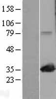 MAPRE1 Human Over-expression Lysate