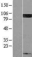 PIP5KI gamma (PIP5K1C) Human Over-expression Lysate
