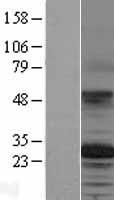 TSPAN12 Human Over-expression Lysate