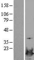 LSM4 Human Over-expression Lysate
