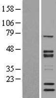 NCOA62 (SNW1) Human Over-expression Lysate