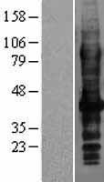 LAT2 (SLC7A8) Human Over-expression Lysate