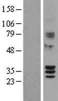 SIRT4 Human Over-expression Lysate