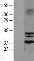 SIRT3 Human Over-expression Lysate