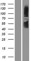 SIRT1 Human Over-expression Lysate