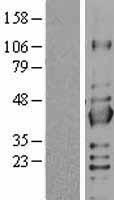 SIRT2 Human Over-expression Lysate