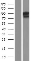 TFIP11 Human Over-expression Lysate