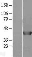 AHA1 (AHSA1) Human Over-expression Lysate