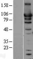 HSP90AB1 Human Over-expression Lysate