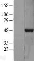TDP43 (TARDBP) Human Over-expression Lysate