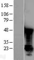 PARK7 Human Over-expression Lysate