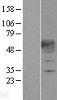 KLF12 Human Over-expression Lysate