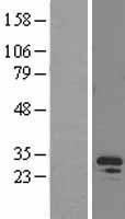 EAP30 (SNF8) Human Over-expression Lysate