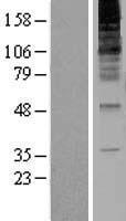 RNF139 Human Over-expression Lysate