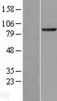 SEC63 Human Over-expression Lysate