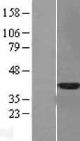 Annexin A10 (ANXA10) Human Over-expression Lysate