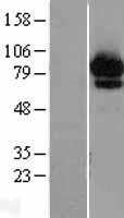 ABCF2 Human Over-expression Lysate
