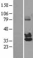 NUDT6 Human Over-expression Lysate