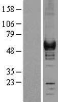 Coronin 1a (CORO1A) Human Over-expression Lysate
