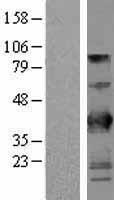 BTN3A2 Human Over-expression Lysate