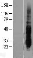 DUSP14 Human Over-expression Lysate