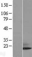 Sumo 3 (SUMO3) Human Over-expression Lysate