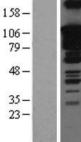 SOX5 Human Over-expression Lysate