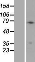 Melanoma gp100 (PMEL) Human Over-expression Lysate