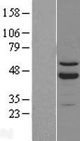 ROR beta (RORB) Human Over-expression Lysate