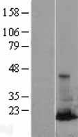 RAB31 Human Over-expression Lysate