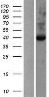 GLIPR1 Human Over-expression Lysate