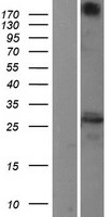 TMP21 (TMED10) Human Over-expression Lysate