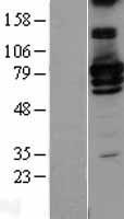 RALBP1 Human Over-expression Lysate