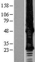 GJB6 Human Over-expression Lysate