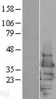 14-3-3 epsilon (YWHAE) Human Over-expression Lysate