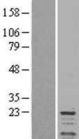 Protein phosphatase inhibitor 1 (PPP1R1A) Human Over-expression Lysate