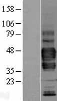 LYVE1 Human Over-expression Lysate