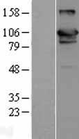 USP20 Human Over-expression Lysate